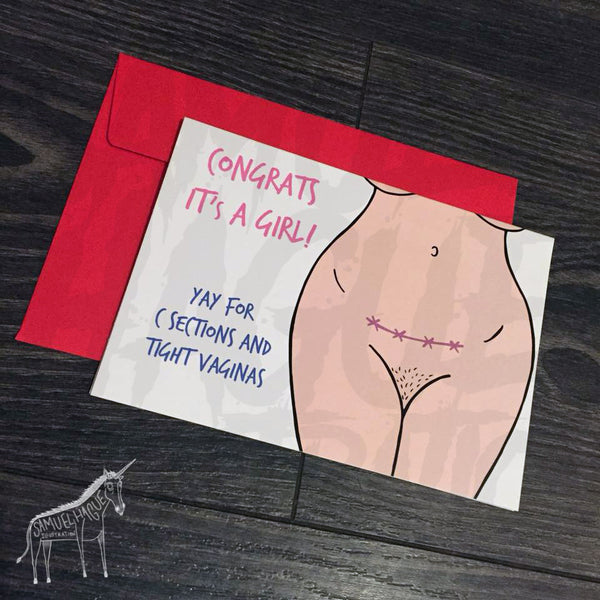 Congrats it's a Girl / C Section - Baby Arrival Card